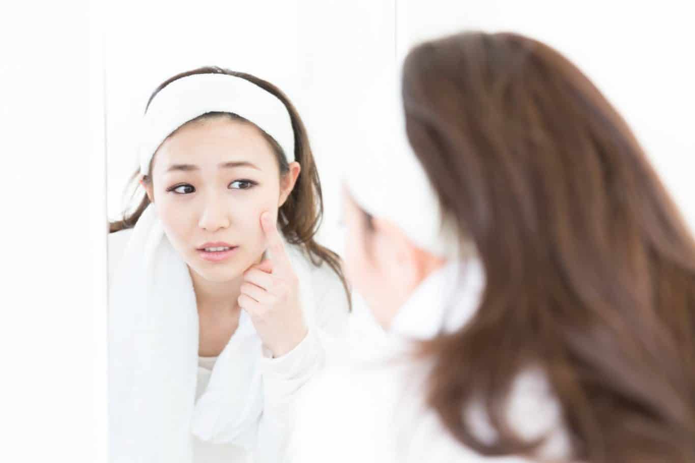Acne Scars & Acne Treatment In Malaysia (KL & Petaling Jaya)