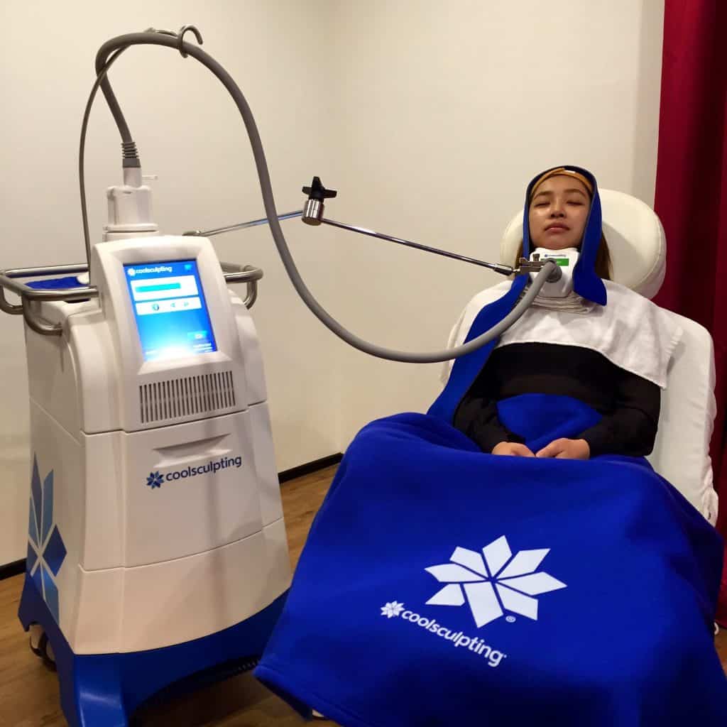Double Chin - CoolMini 1 Double Chin Removal & Treatment - Clique® Clinic Malaysia
