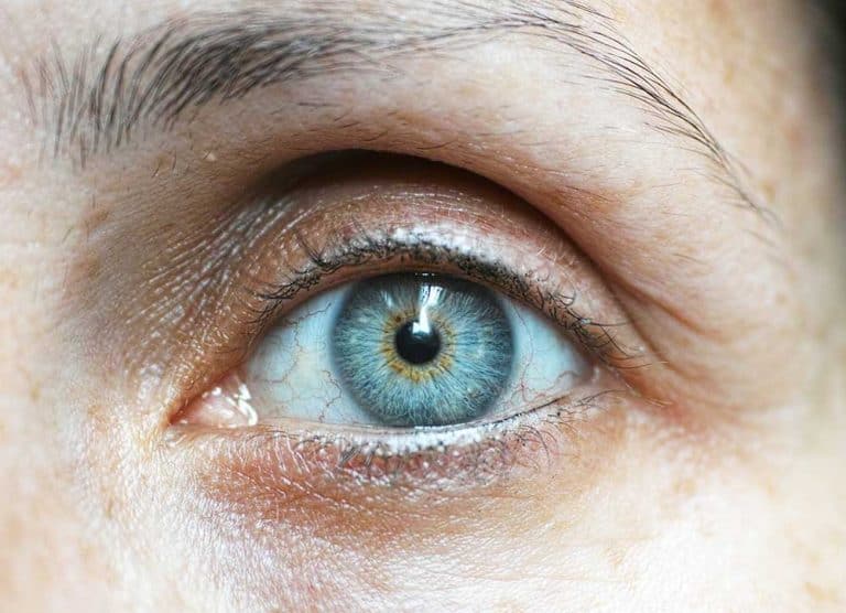 Eye Bag and Dark Eye Circle - clique eye bag 2 Eye Bag & Dark Eye Circle Treatment - Clique® Clinic