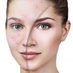 Clique Clinic Aesthetic Treatment
