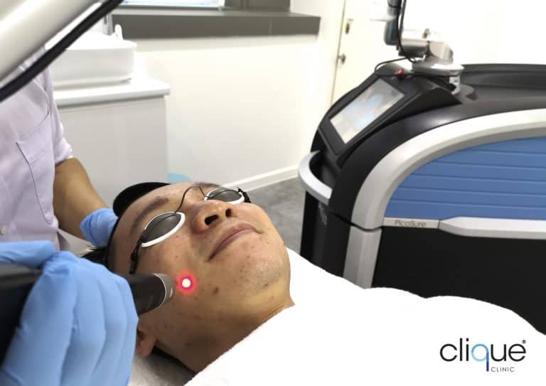 Read more about the article Best Laser for PIH (Post-Inflammatory Hyperpigmentation): PicoSure & Beyond