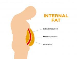 Read more about the article Abdominal Fat: Health Risks and 10 Effective Treatment Options