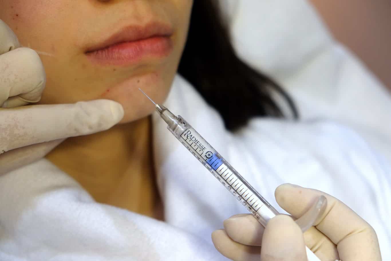 You are currently viewing What Does A Dermal Filler Do?