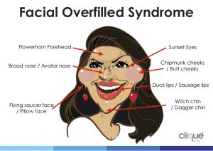 Facial overfilled syndrome