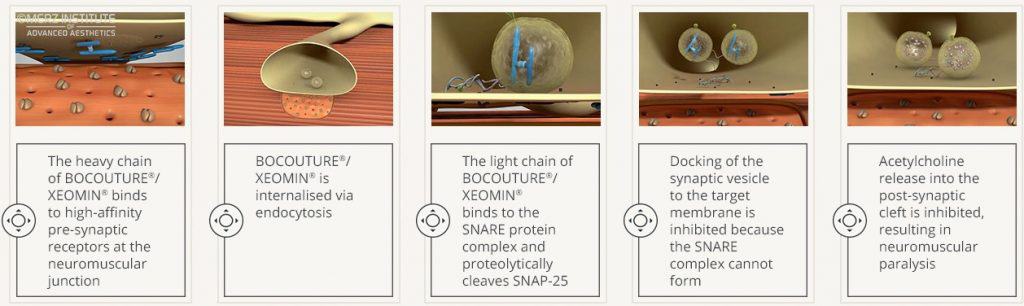 Xeomin - Produktkurs A s1 p11 2 Xeomin Bocouture Neuromodulator Anti Wrinkle