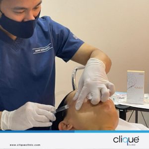 Read more about the article 5 Things You Need To Know About Plinest