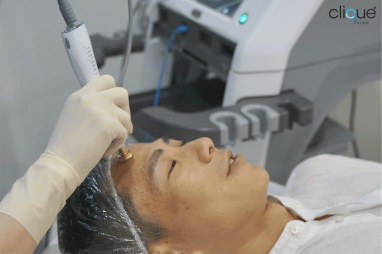 Read more about the article TempSure with Plinest or Profhilo