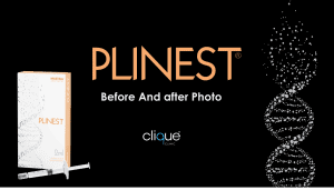 Read more about the article Plinest Injection Before And After