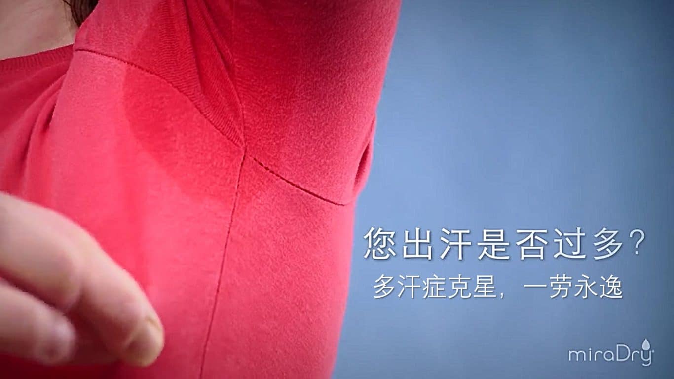 You are currently viewing miraDry清新微波，多汗症克星，1 劳永逸