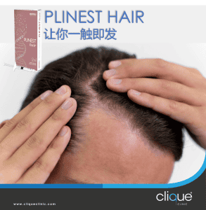 Plinest hair lost injection