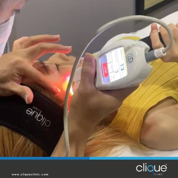 Read more about the article Digital Peel: The death of PICO laser?