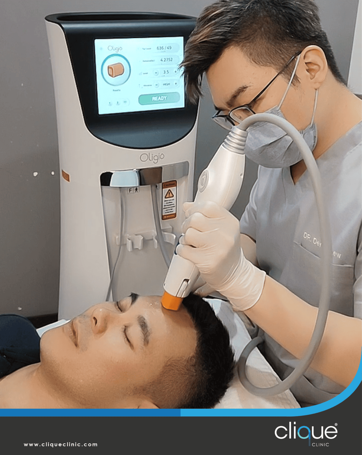 You are currently viewing Oligio lifting the hottest face lifting treatment