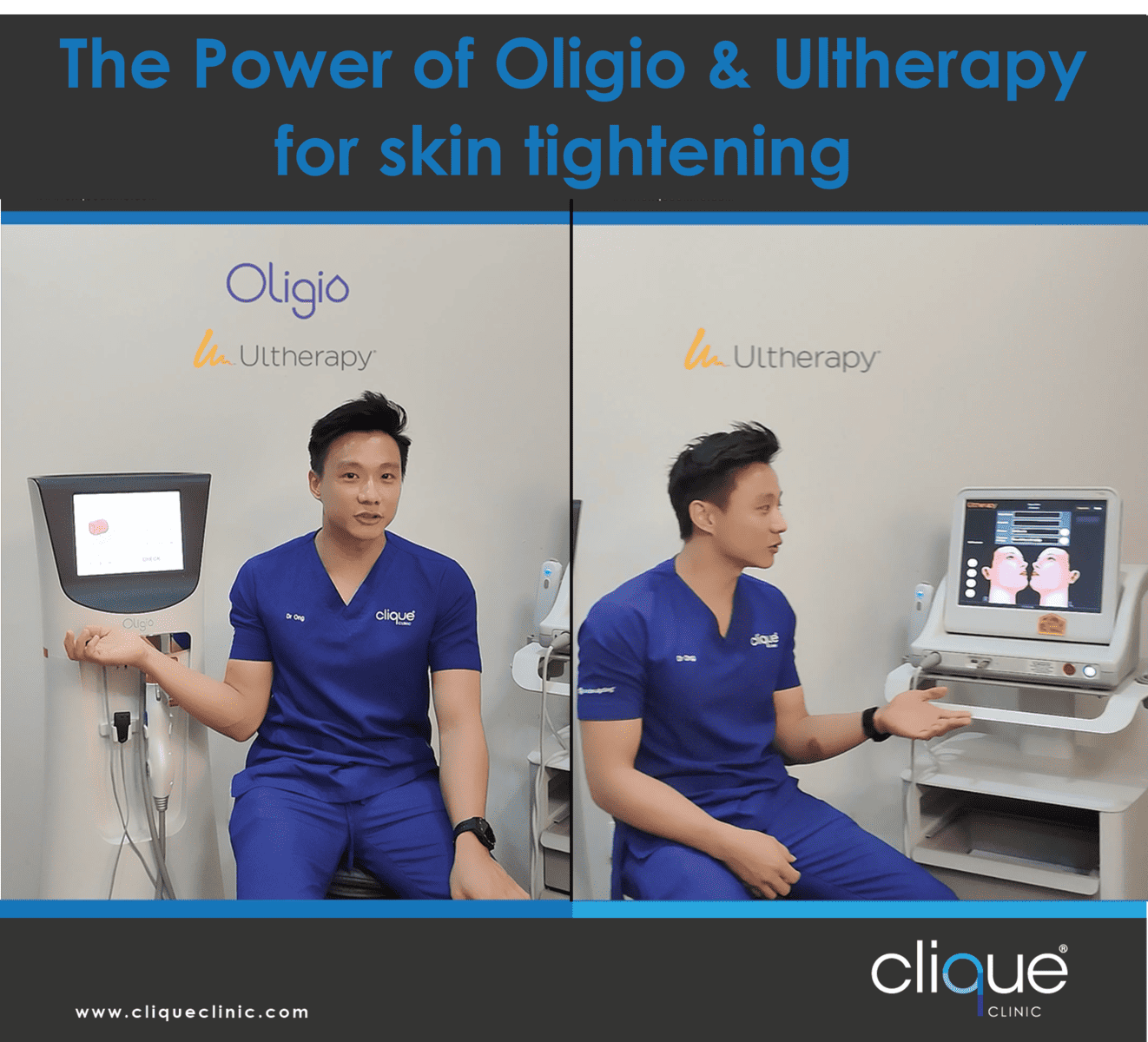 You are currently viewing The Power of Oligio vs Ultherapy for skin tightening