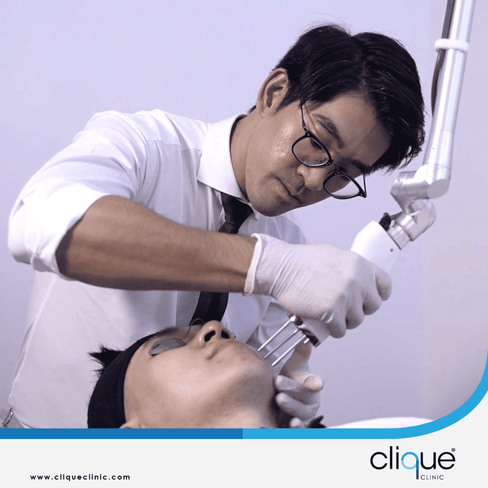 You are currently viewing How often should I do Pico Laser? 5 things you should know