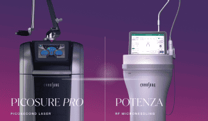 Cynoglow = PicoSure Pro + Potenza
