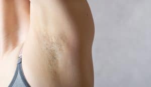 Read more about the article The Ultimate Guide To Smooth, Hair-Free Skin: Effective Permanent Hair Removal Methods