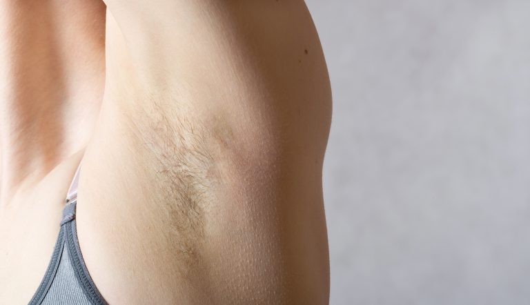 Read more about the article The Ultimate Guide To Smooth, Hair-Free Skin: Effective Permanent Hair Removal Methods