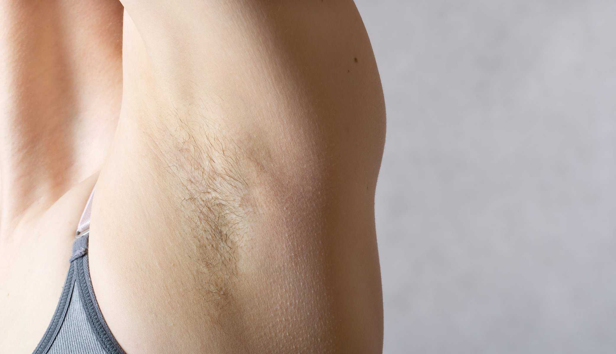 You are currently viewing The Ultimate Guide To Smooth, Hair-Free Skin: Effective Permanent Hair Removal Methods