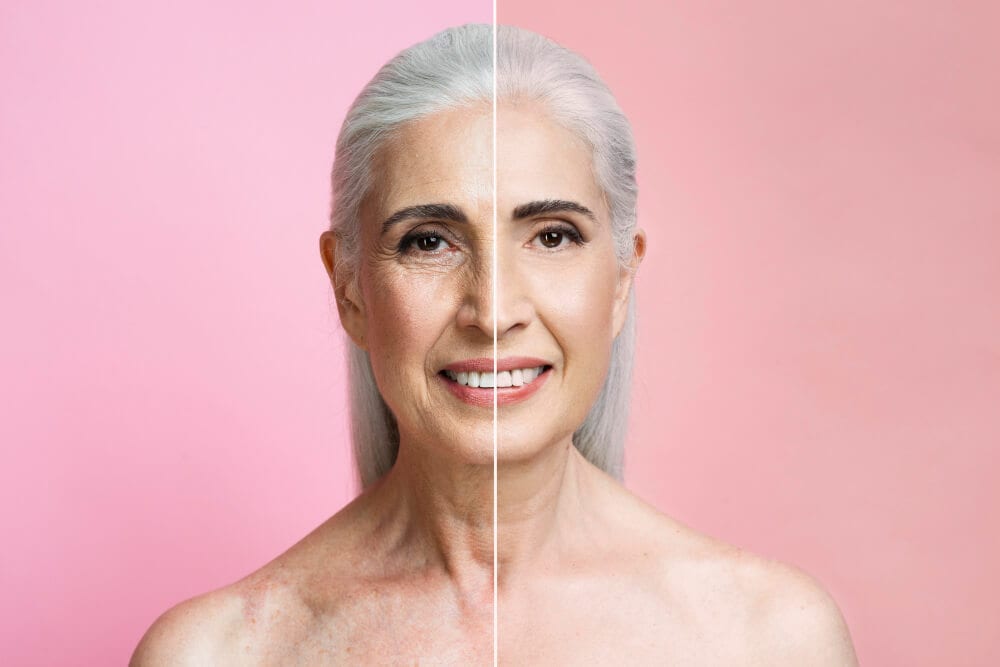 anti ageing