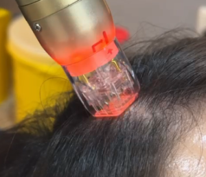 Hair Treatment - Sylfirm x for scalp e1783579220716 2