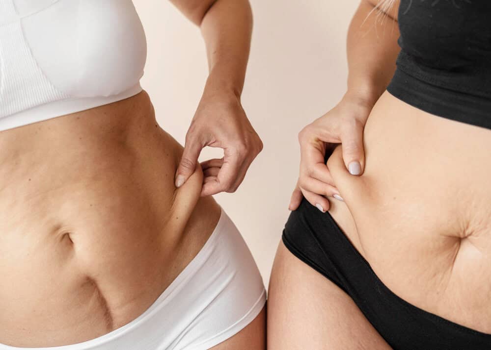 Love Handles: Causes, Why They’re Hard to Lose, and How to Reduce Them - Love Handles 2 Love Handles