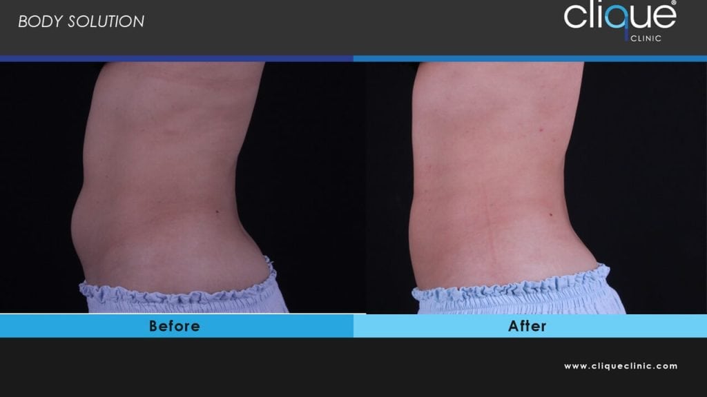 before and after Cristal Pro Treatment
