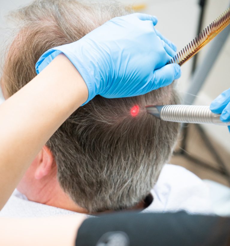 Hair Treatment - DSC08604 e1783581294799 4