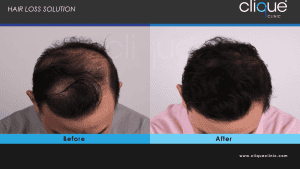 Hair Treatment - new ba 2 new b&a