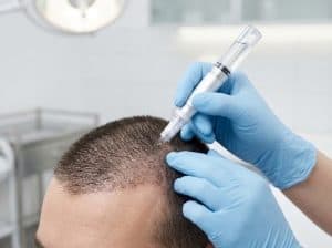 Read more about the article Exosome Therapy for Hair Loss: How It Works & Benefits
