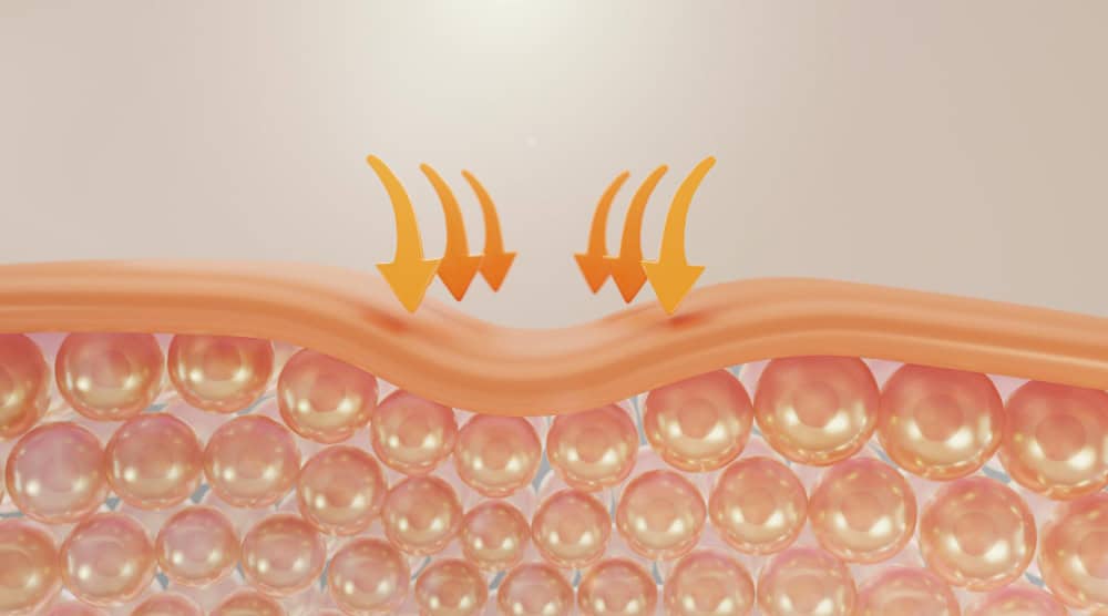 Exosomes vs Vitamin C: Their Differences & How They May Complement Each Other - Exosomes for collagen 3 Exosomes for collagen